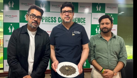 41 वर्षीय मरीज के गॉलब्लैडर से निकले 4,000 से ज्यादा स्टोन